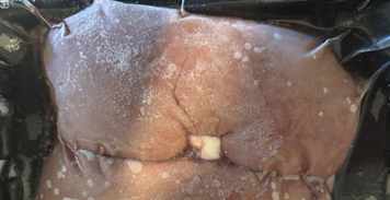 Photo of kidneys